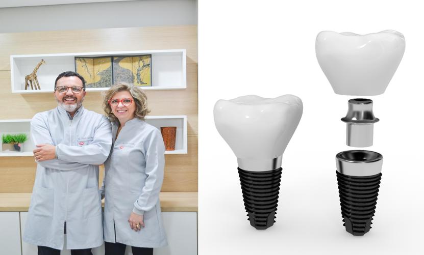 Implantes Dentários
